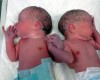 Twins Hold Hands after Birth